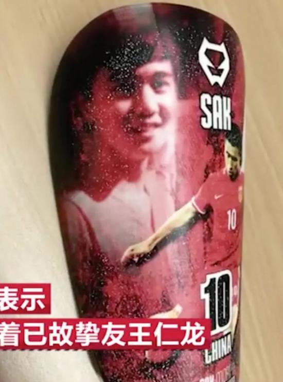 张源的护腿板上印有好友王仁龙的照片