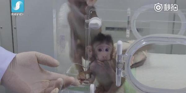 换头手术真的有成功的可能吗 nT6D-fyqwiqk4344942.jpg