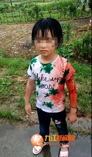 都昌县发生一起女童遭陌生女子拐走并持刀砍伤事件:8岁女孩小怡(化名)
