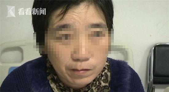震惊！女子被风吹袭受凉致面瘫 深秋寒风如此可怕
