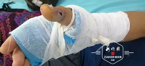 蛇在高度酒精中浸泡一年竟然不死?