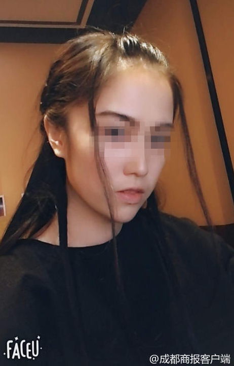 胡瑶整容前