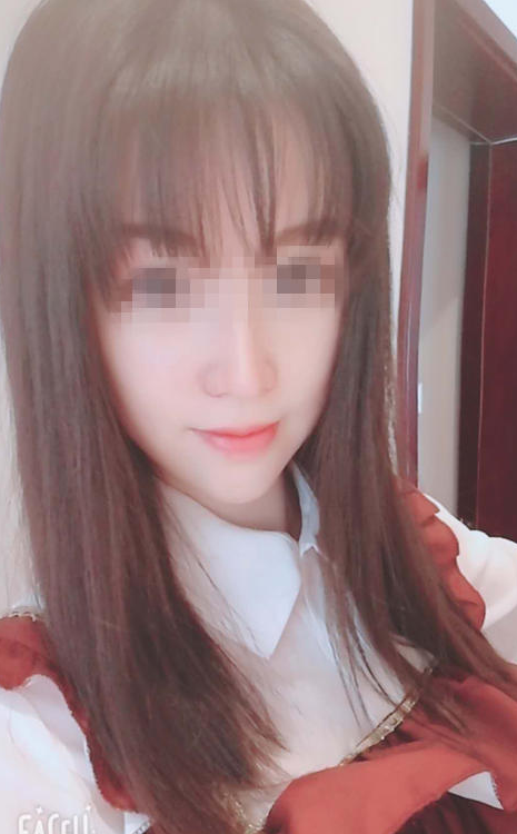 胡瑶整容后