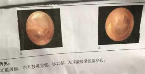 李姐诊断结果
