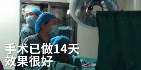 医生表示:“手术非常成功,现在术后已经14天了,效果非常的好”。