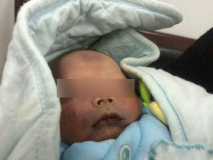 被丢弃的婴儿。（网友供图）