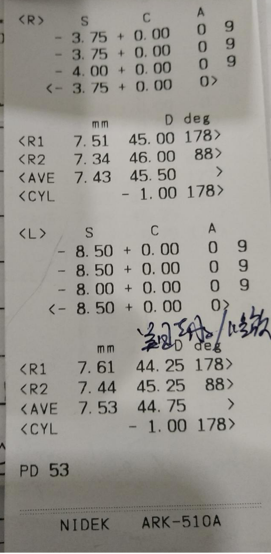 正常的眼睛度数是多少度,正常的眼睛度数是多少度左右