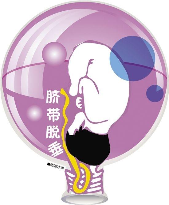 网络配图