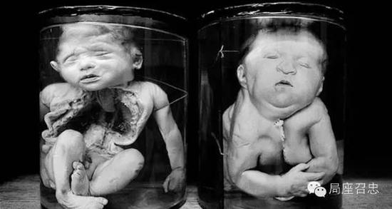 苏联为什么解体?切尔诺贝利核爆炸是一个转折点