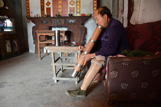 陈正方左腿在触雷后截肢,他坐在自家沙发上抽烟,他先后触雷三次被炸。