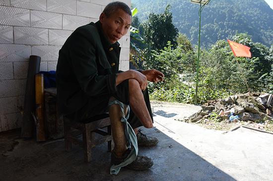 邹大聪在自家门口台阶,他的右下肢触雷后被截肢,干不了重活。