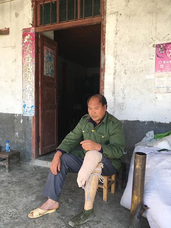陈正方先后触雷三次被炸,他的左腿被截肢。