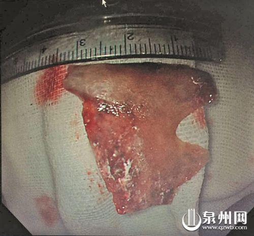 取出的鸭骨头 取出的鸭骨头