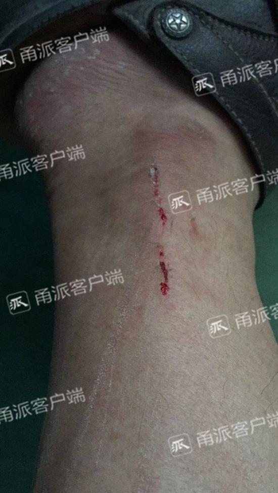从昨天晚上,危小虎是趴在床上睡的。