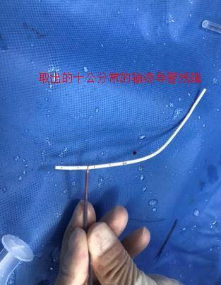 使用输液港、PICC的患者,要注意日常维护