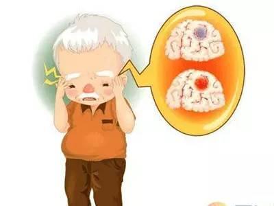 甬1男子易怒致脑血管破裂 医生提醒注重脑血管