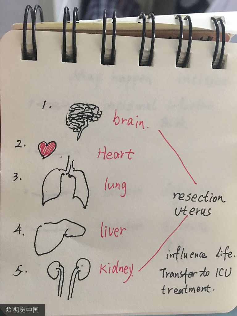 一级免费毛片