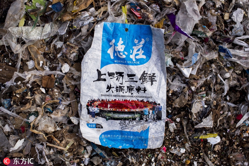 陰道擴張器