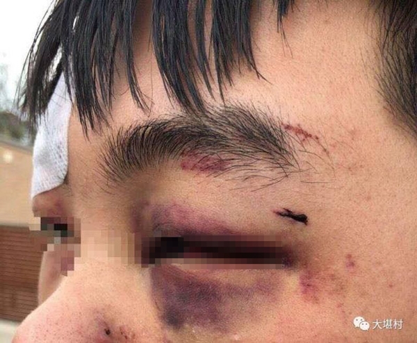 本庄铃无码二区在线视频