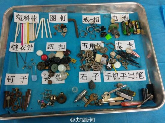 你能相信吗 这都是孩子们吞下过的东西