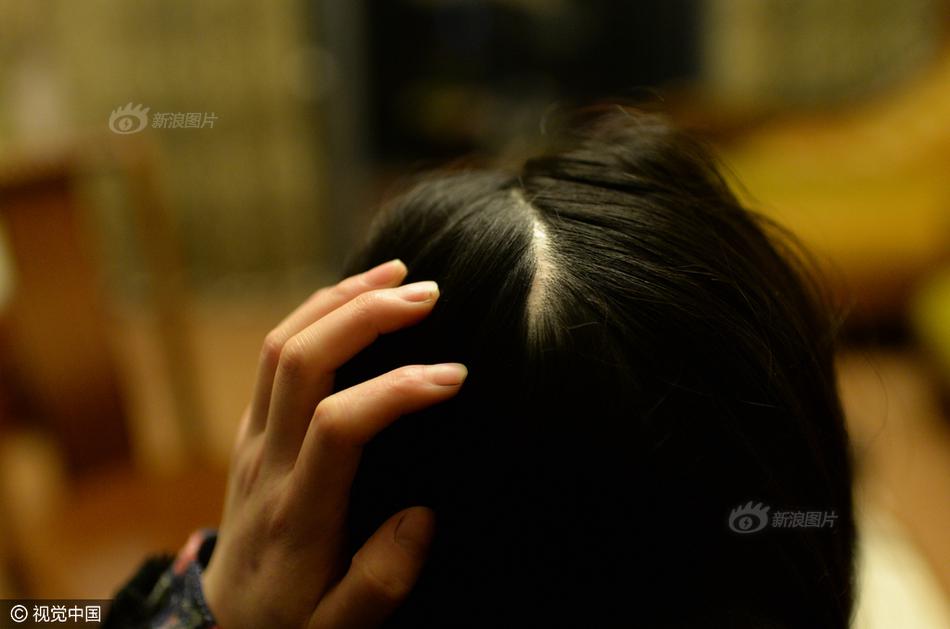 另类国外巨大荫蒂