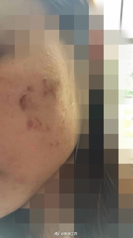 老女人乳房