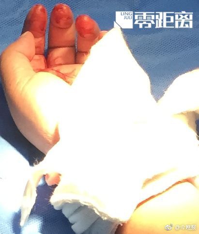 四季度需求有望改善生猪价格或维持区间震荡