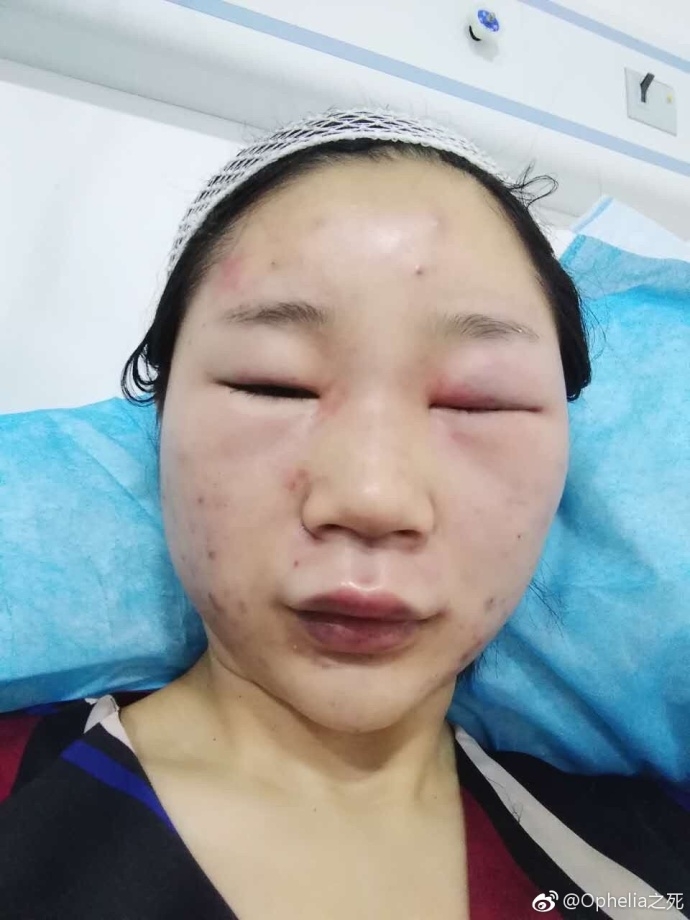 中国护士黄色大片儿
