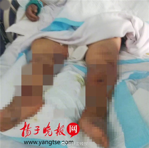 廚房圍裙