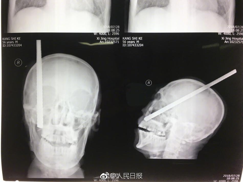 ChineseGayXXX搓澡