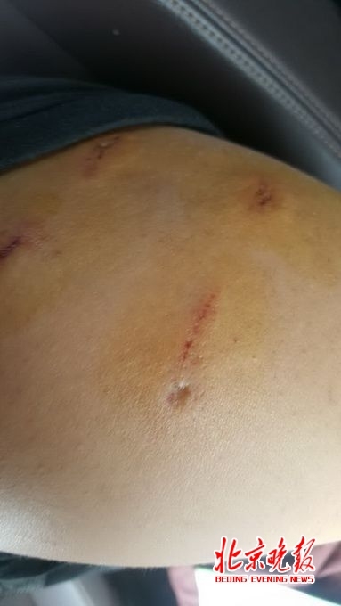 美女扒开尿口让男人桶