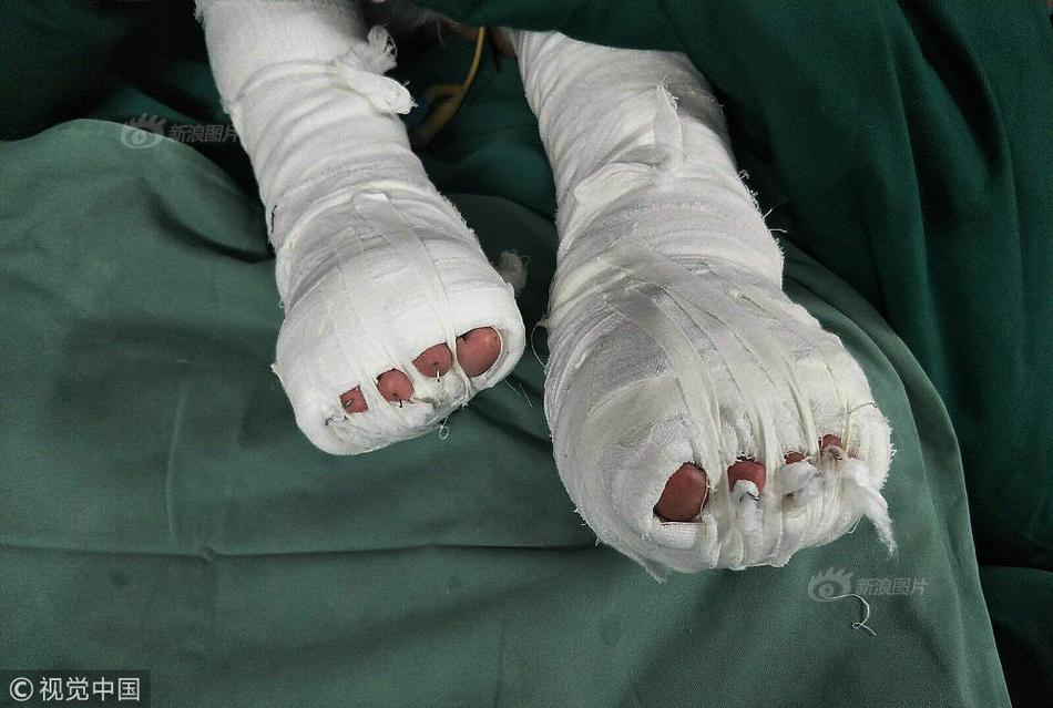 剛毛熟女