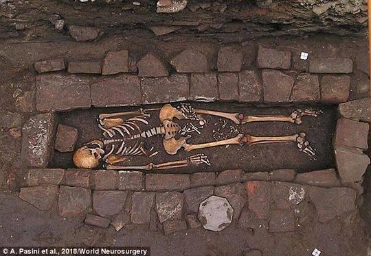 中世纪孕妇38周时死亡 被埋葬后“生下”胎儿