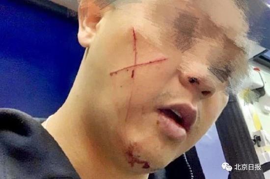 休班警長被割傷。圖片來源:fb@葛珮帆