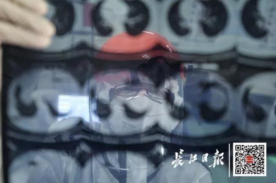 午饭后,张医生(中)在CT室查看上午拍的片子。