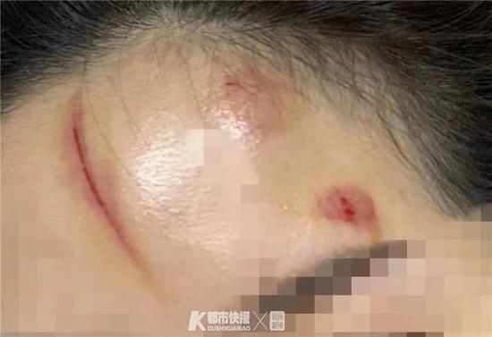 沙巴体育官网沙巴体育平台|铲屎官遛狗引众人围观,狗狗勉强用脚丫触地:敢不敢让我自己走?