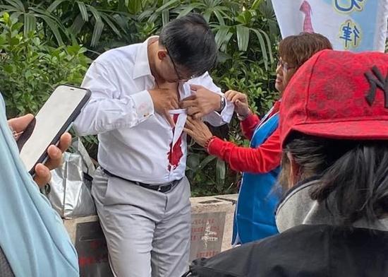 2018送彩金的博彩论坛,脾胃湿热、肝胆湿热,两者有大区别,4招预防各种湿热