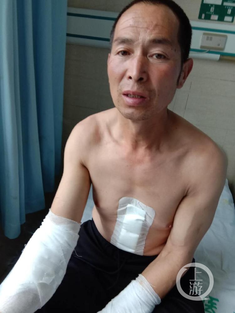 在合力打死王雷之前,王新元胸腹、腿、双臂受伤