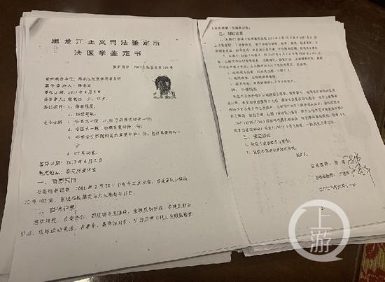 女子遭抢劫毁容:警方丢失卷宗 法院作出阴阳判决