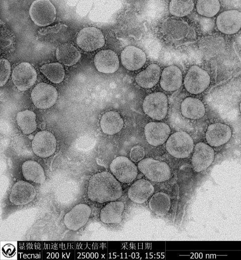 电子显微镜下SARS样冠状病毒粒子的形态结构 (图片来源于中国科学院武汉病毒研究所杨兴娄副研究员)