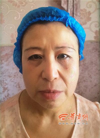 38岁的王女士说,她在此洗了眼线,做了切眉手术后,感觉自己"变老"了,有