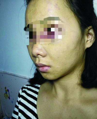 女子称夜晚独行遭陌生男子拖拽殴打(图)|女子独