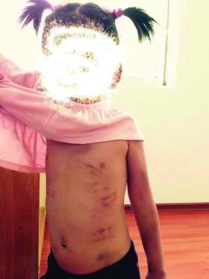 镇江疑家暴女童母亲回应:部分为伤痕奶奶管教造成