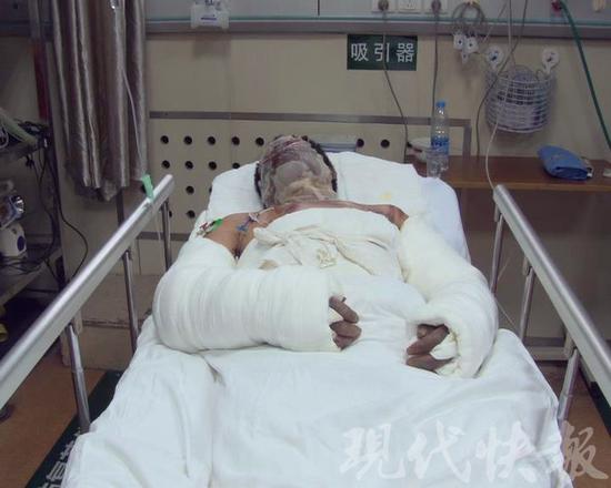 男子不堪被讨赌债点火自焚 送医后家属失联