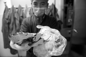 10月30日,长沙市中心医院,医生展示周师傅泡水喝所用的“药材”。图/记者辜鹏博