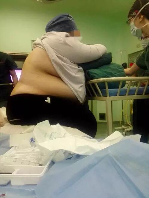 浙大妇院14日救治的这位产妇体重达260斤。 医院供图