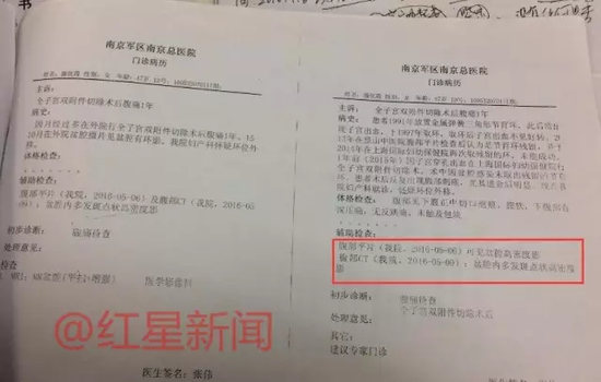 　　多家医院相继检查出滕优霞盆腔内多发斑点状高密度影