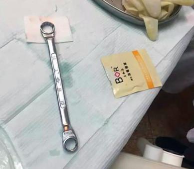 男子下体被套住17小时 最后口腔科医生解了围 由于病情特殊,医院立即召集急诊科、泌尿科、骨科等相关科室进行联合会诊。