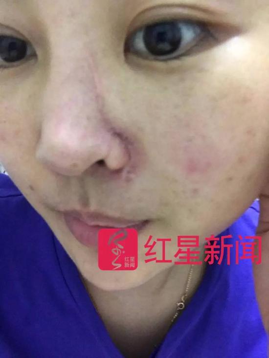 ▲被打女子小董的近照受访者供图