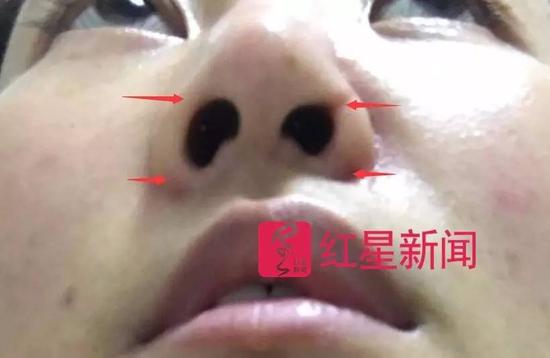 ▲被打女子小董的近照受访者供图